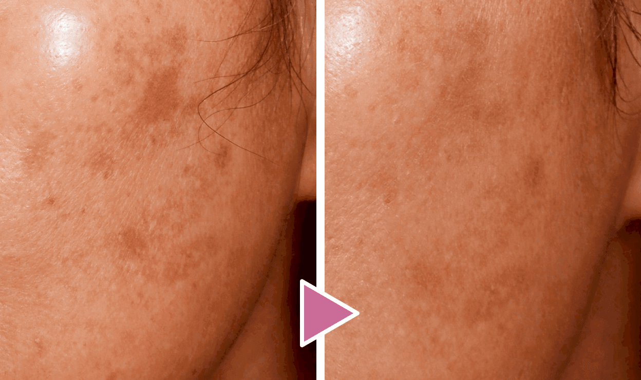 40代 女性 症例写真