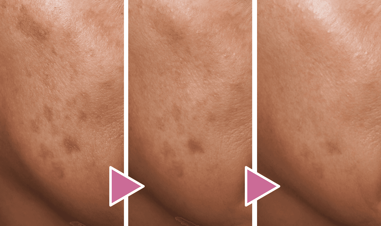 50代 女性 症例写真